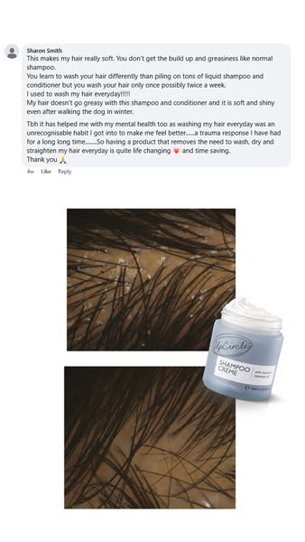 UpCircle ad: Say Goodbye to Itchy Scalp😍