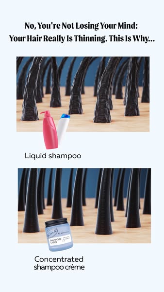 UpCircle ad: Not Dandruff? It’s Inflammation 😱