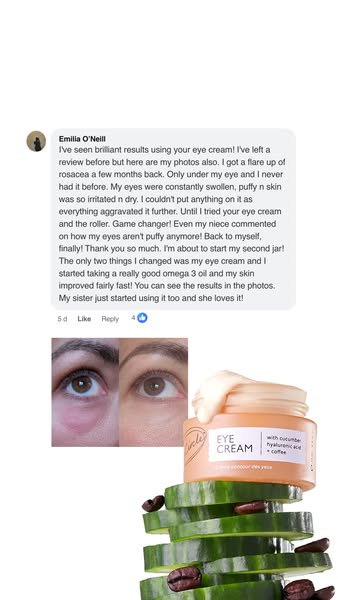 UpCircle ad: "My dark circles are gone for good"☕✨