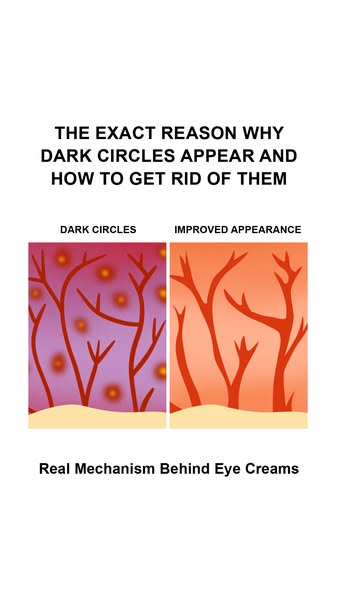 UpCircle ad: "My dark circles are gone for good"☕✨