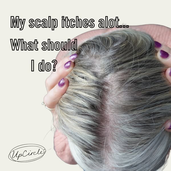 UpCircle ad: Not Dandruff? It’s Inflammation 😱