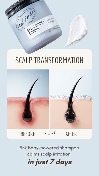 UpCircle ad: Not Dandruff? It’s Inflammation 😱