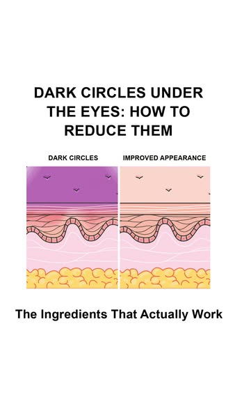UpCircle ad: "My dark circles are gone for good"☕✨