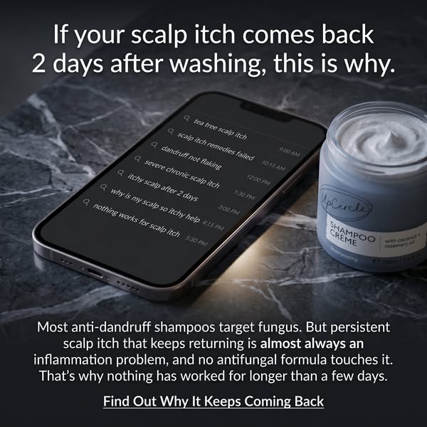 UpCircle ad: Not Dandruff? It’s Inflammation 😱