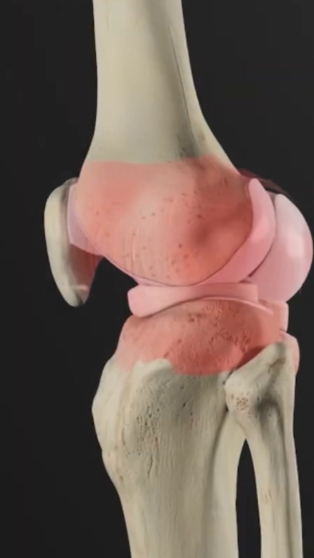 OrthoFlexx ad: Arch Support That Doesn't Collapse