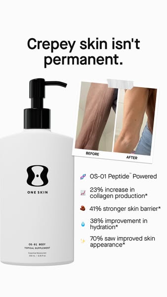 OneSkin ad: Transform crepey skin with OS-01 BODY