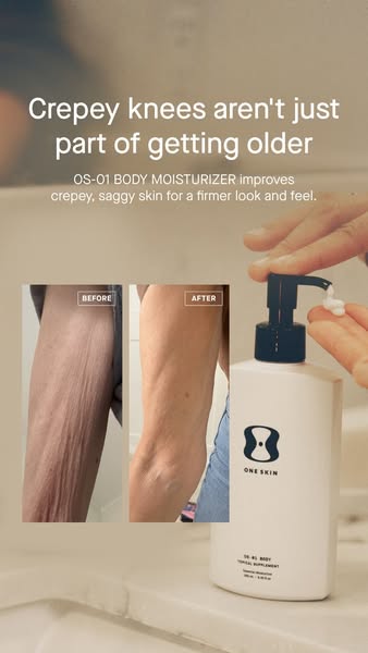 OneSkin ad: Transform crepey skin with OS-01 BODY