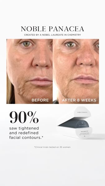 NOBLE PANACEA ad: Unlock the Secret to Perpetual Radiance