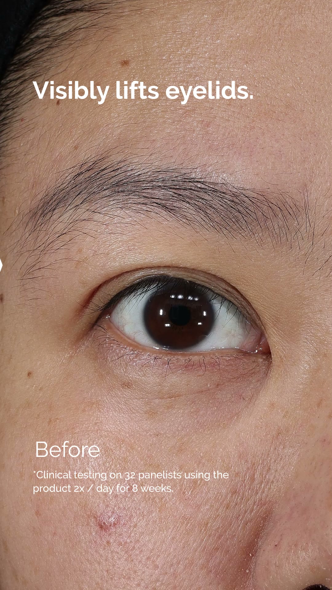 The Ordinary ad: Reimagine What An Eye Cream Can Do.