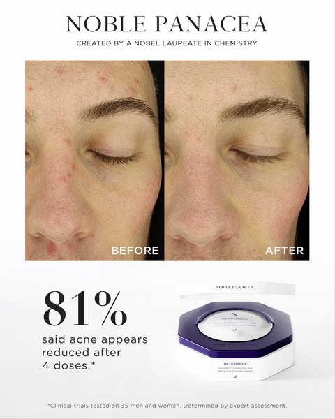 NOBLE PANACEA ad: Wake Up to Radiant Skin