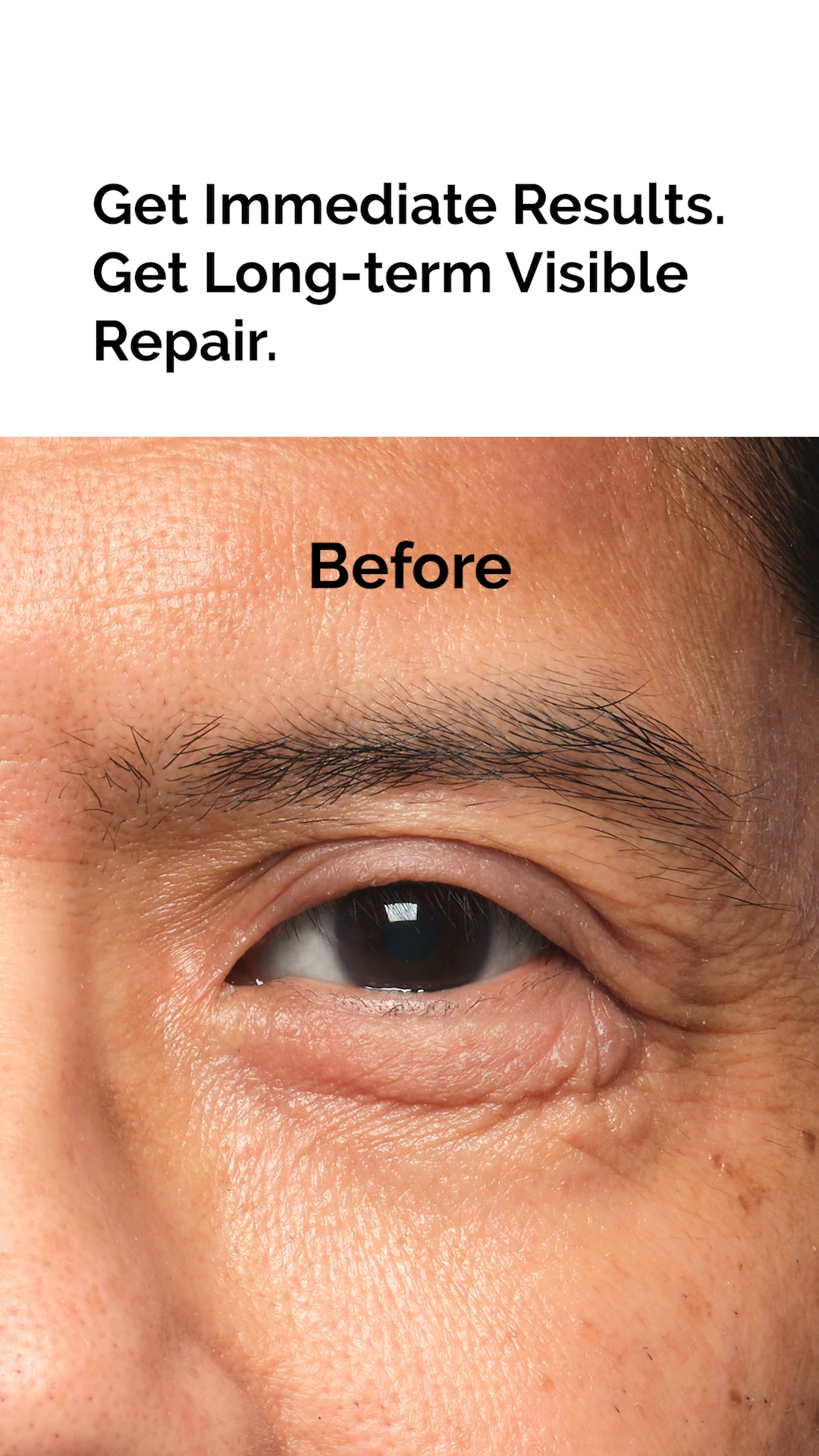 The Ordinary ad: Reimagine What An Eye Cream Can Do.