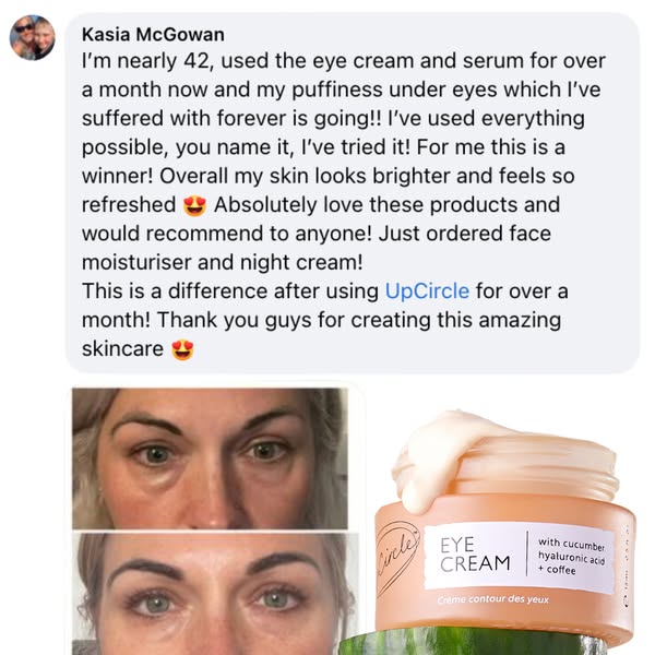 UpCircle ad: "My dark circles are gone for good"☕✨