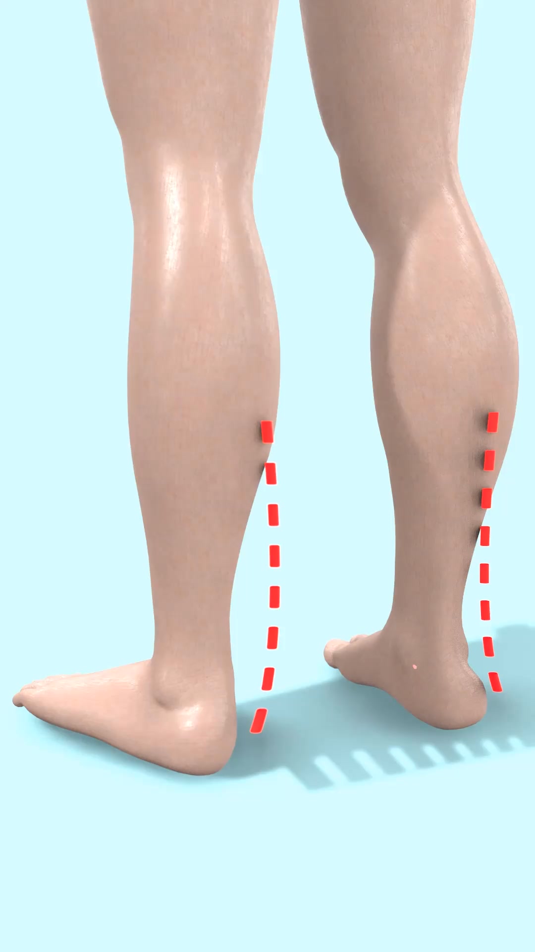 OrthoFlexx ad: Arch Support That Doesn't Collapse