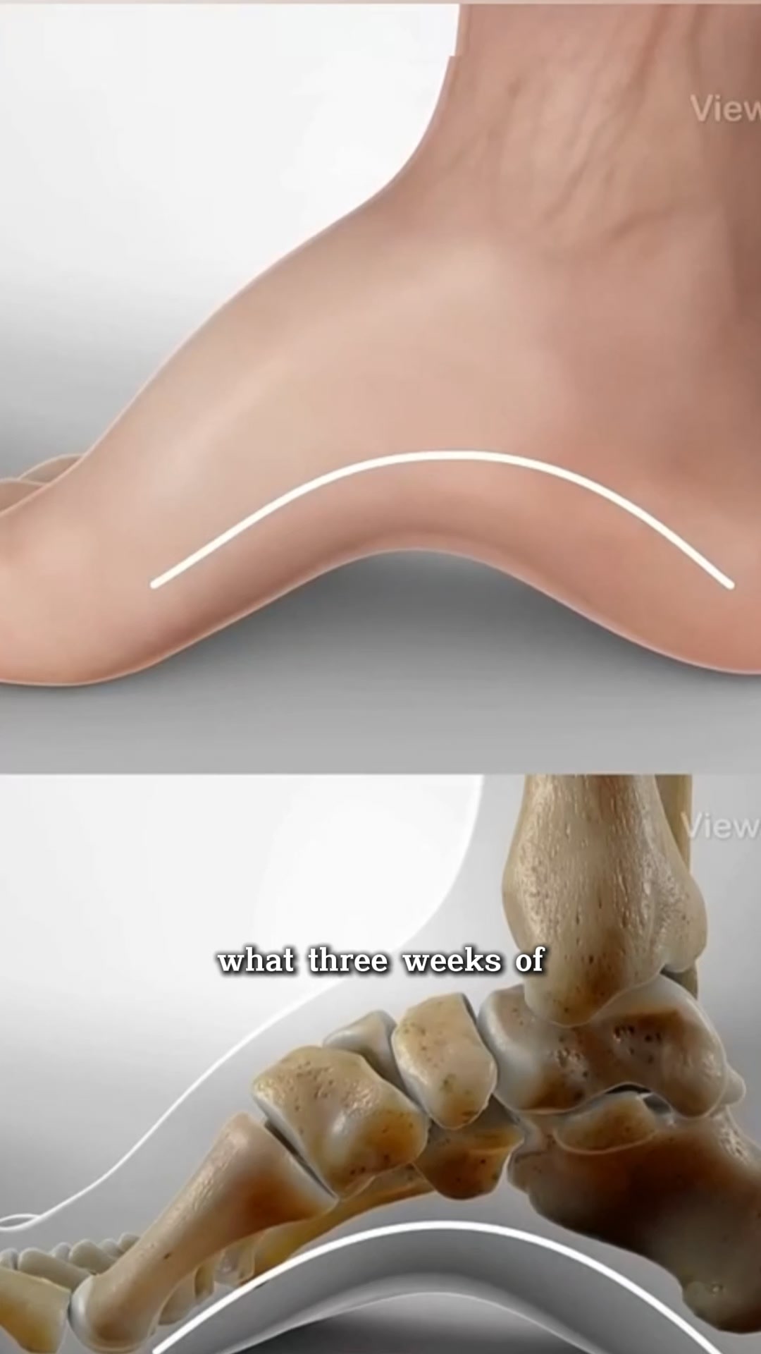OrthoFlexx ad: Say Goodbye to Foot Pain Forever