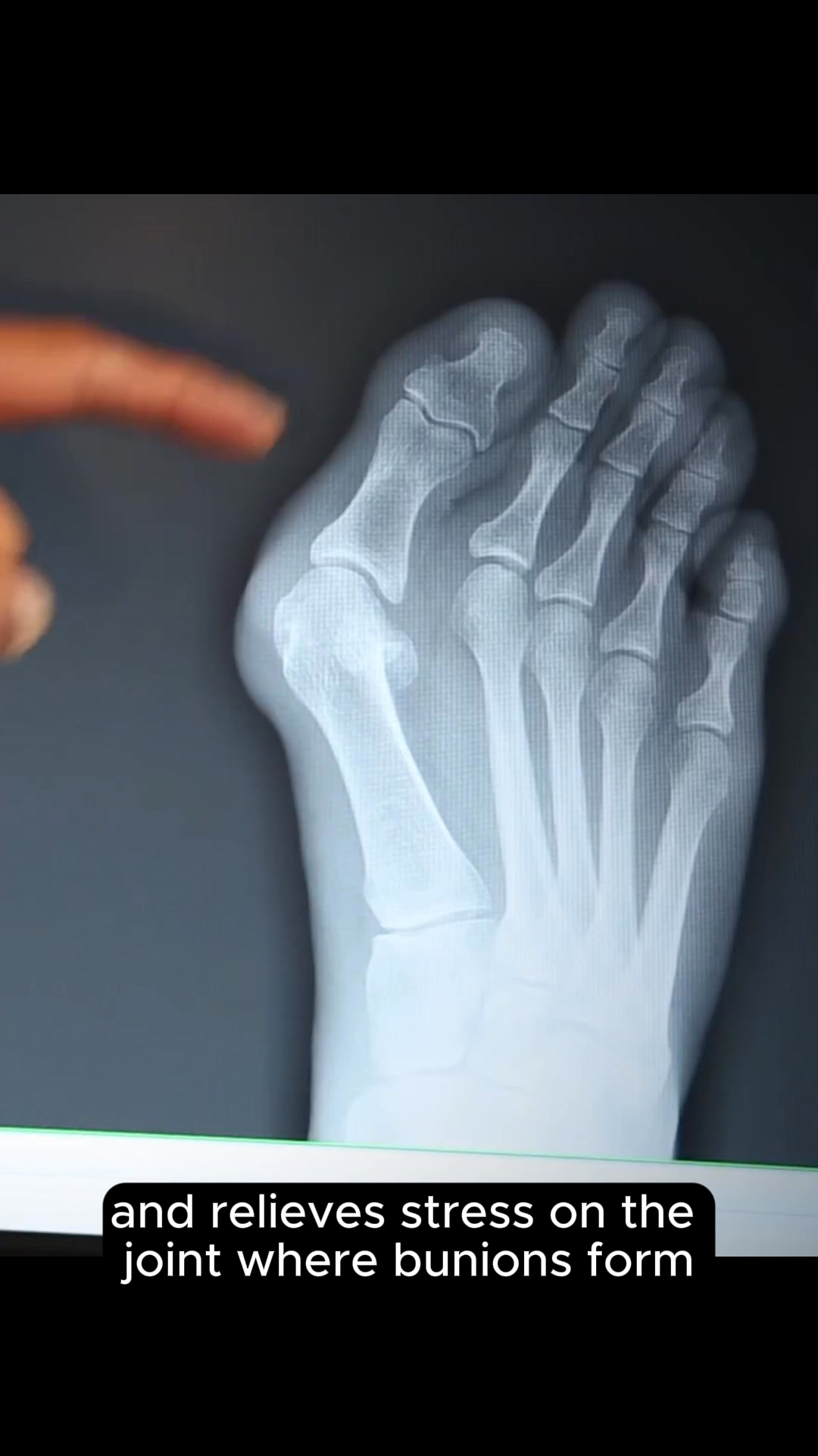 OrthoFlexx ad: Arch Support That Doesn't Collapse
