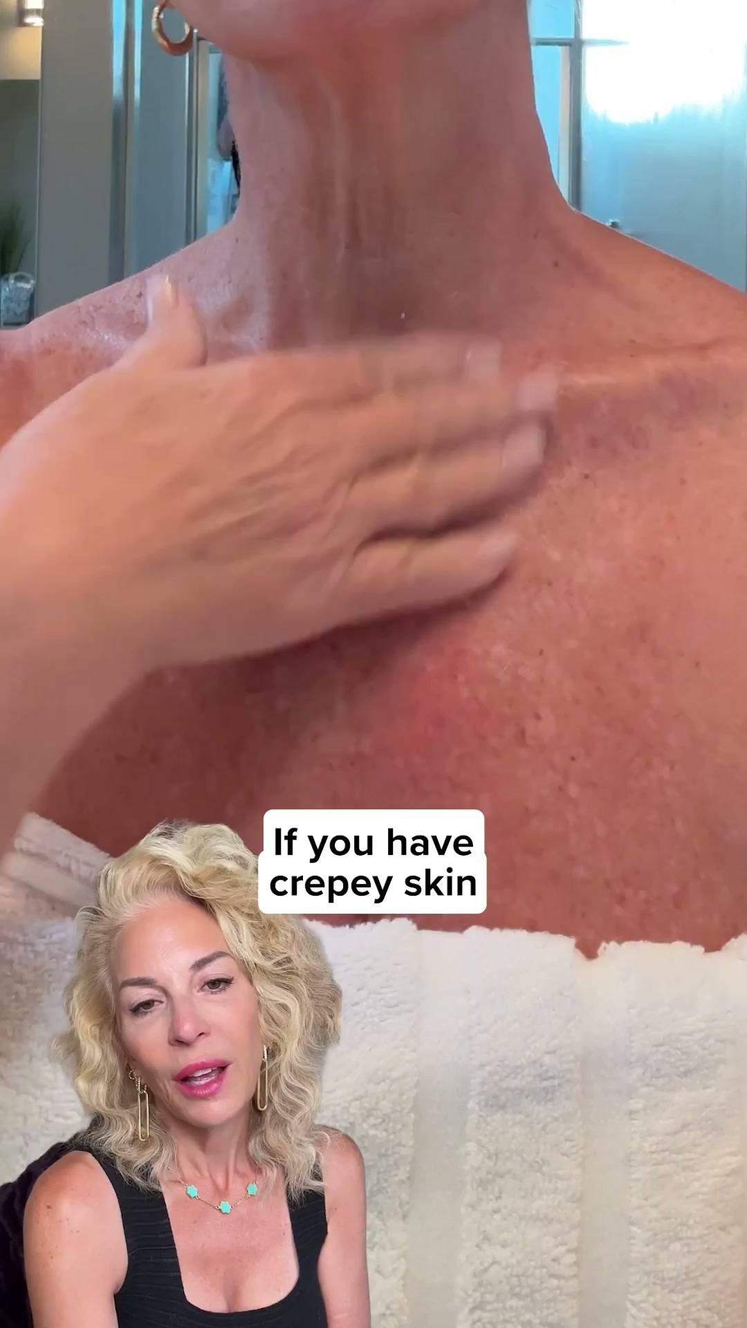 Miami MD ad: Why Lotions Don’t Work for Crepey Skin (and What Actually Does)