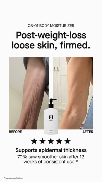 OneSkin ad: Transform crepey skin with OS-01 BODY