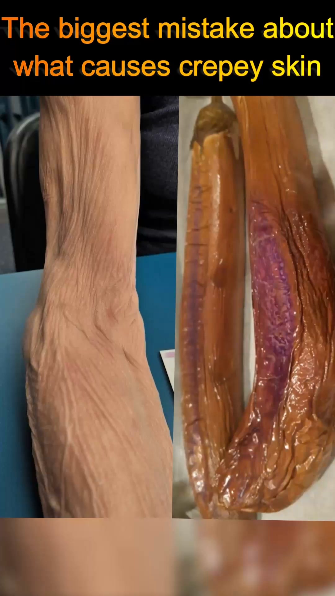 Miami MD ad: The real reason crepey skin won't go away.