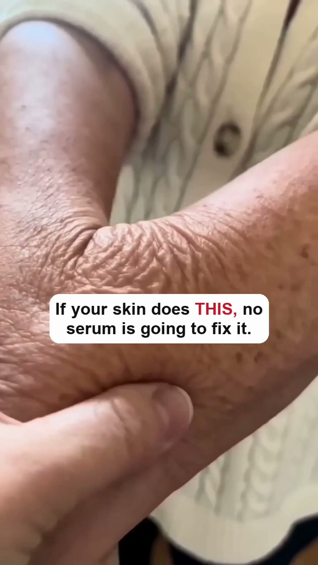 Miami MD ad: Why crepey skin doesn't respond to moisturizer.