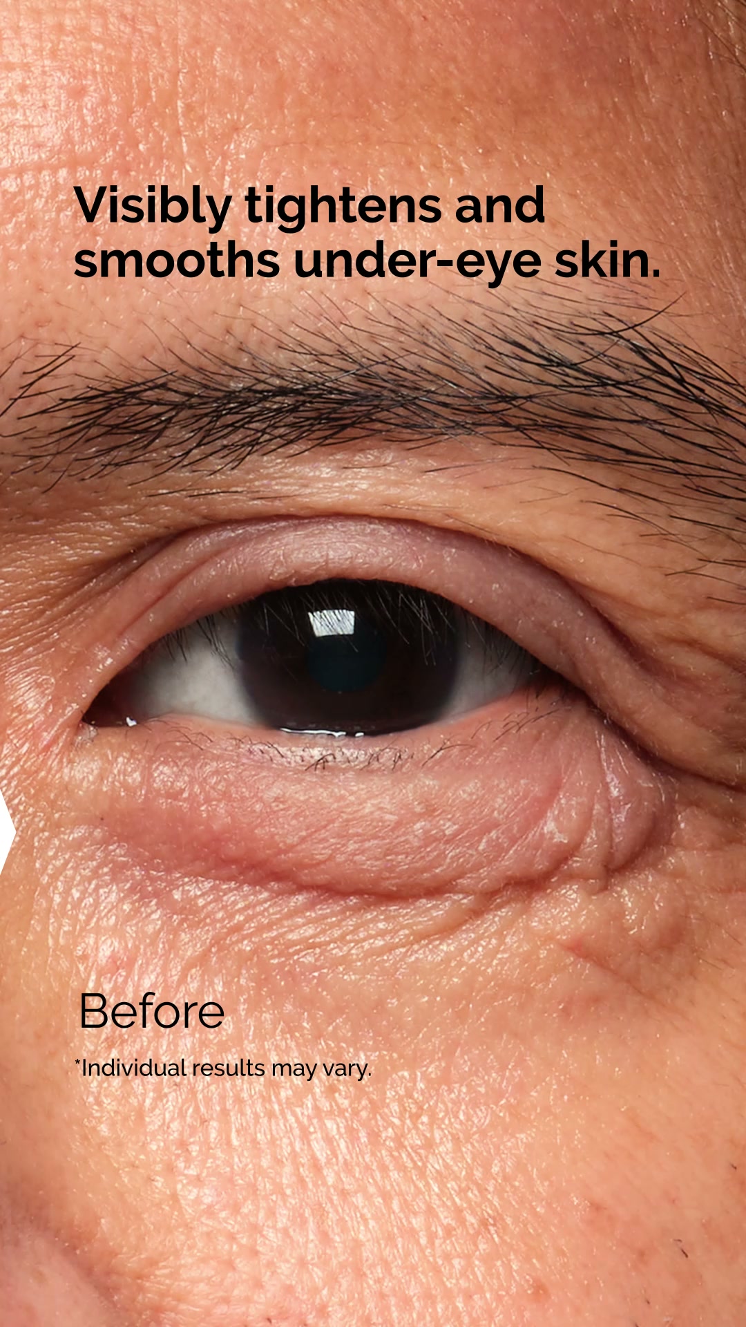 The Ordinary ad: Reimagine What An Eye Cream Can Do.