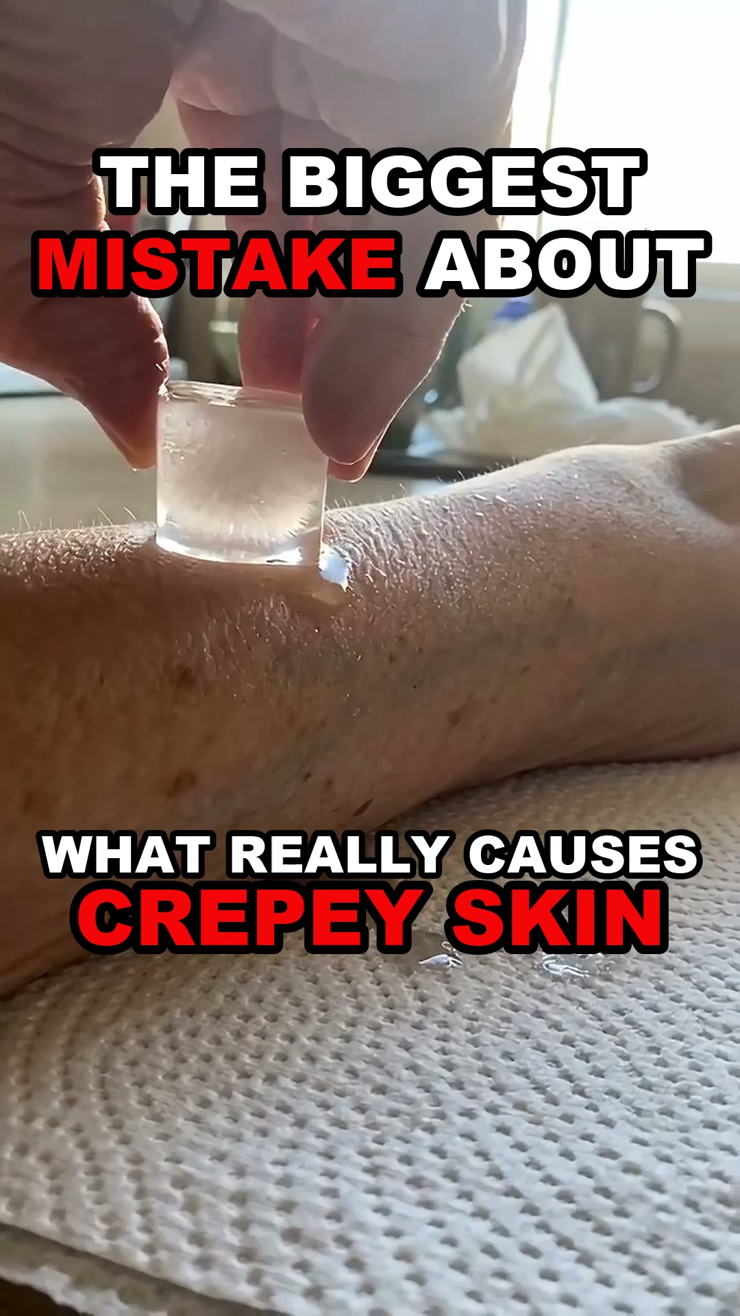 Miami MD ad: The real reason your crepey skin won't stay smooth.