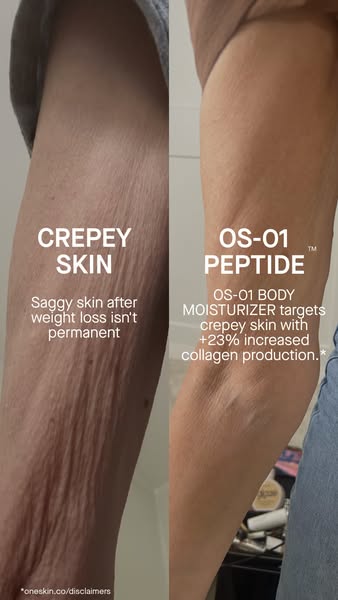 OneSkin ad: Transform crepey skin with OS-01 BODY