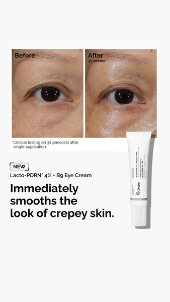 The Ordinary ad: Made to visibly repair eye skin.