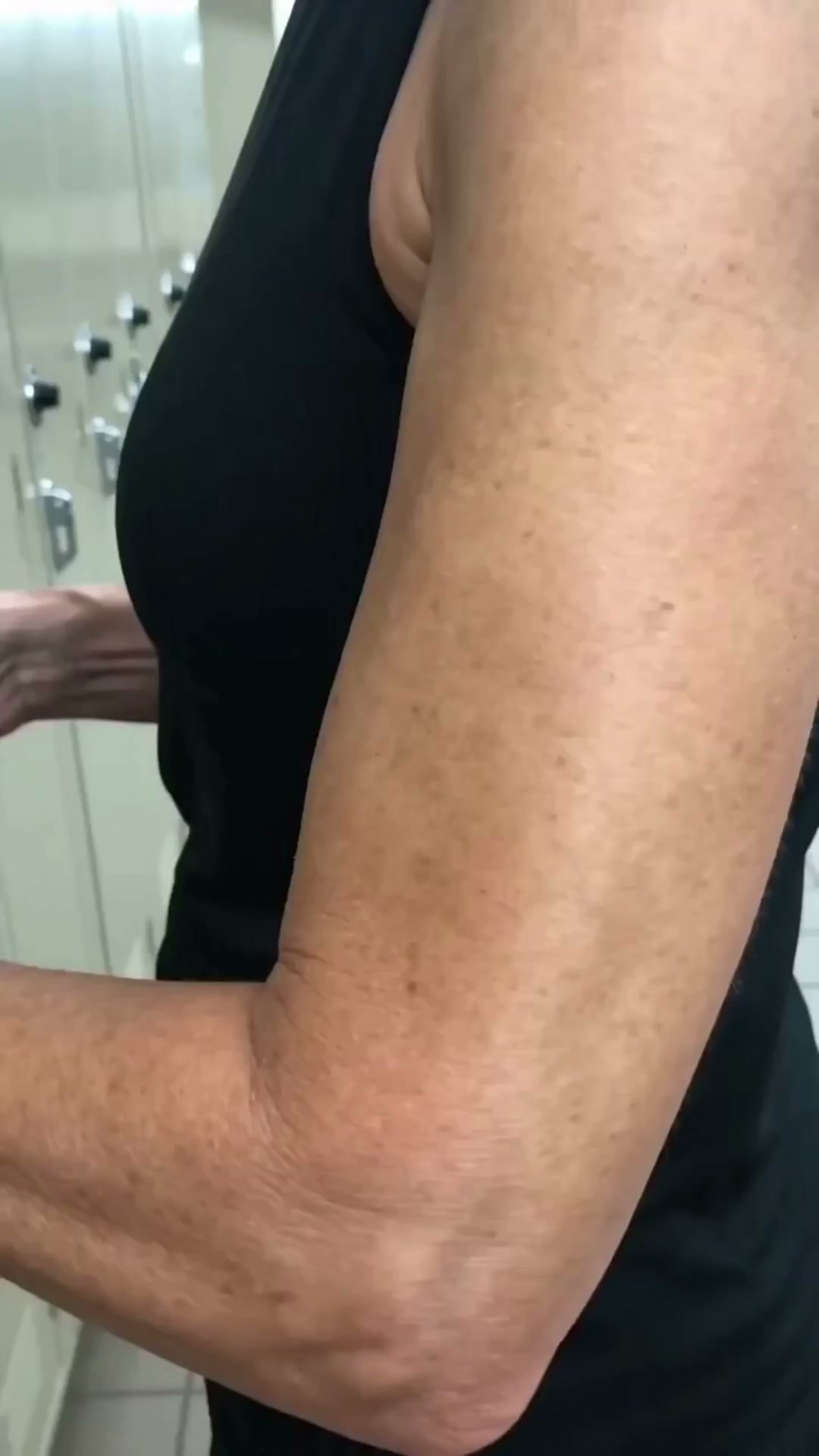 Miami MD ad: Why crepey skin keeps coming back — even after expensive creams.