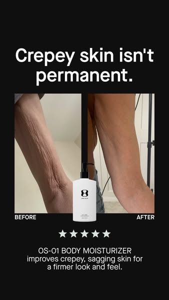 OneSkin ad: Transform crepey skin with OS-01 BODY