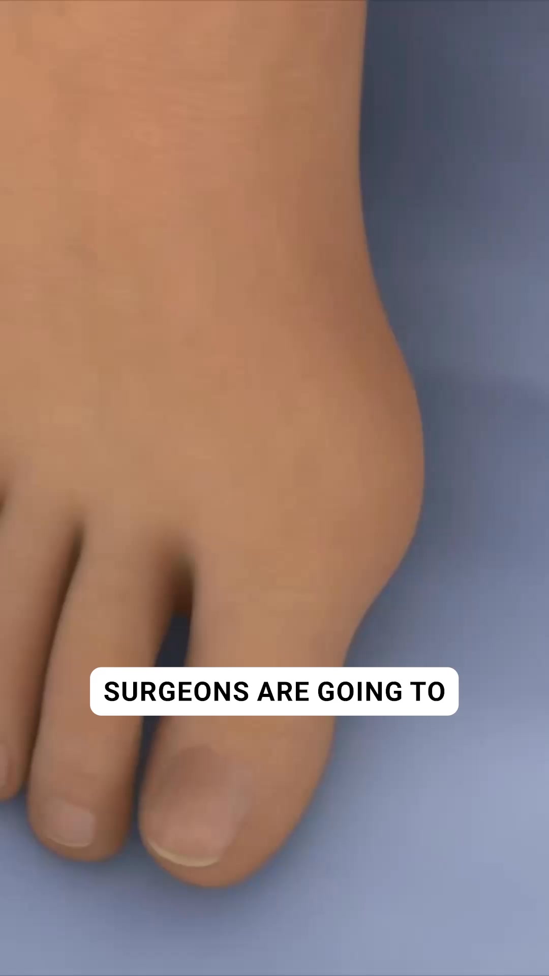OrthoFlexx ad: Arch Support That Doesn't Collapse