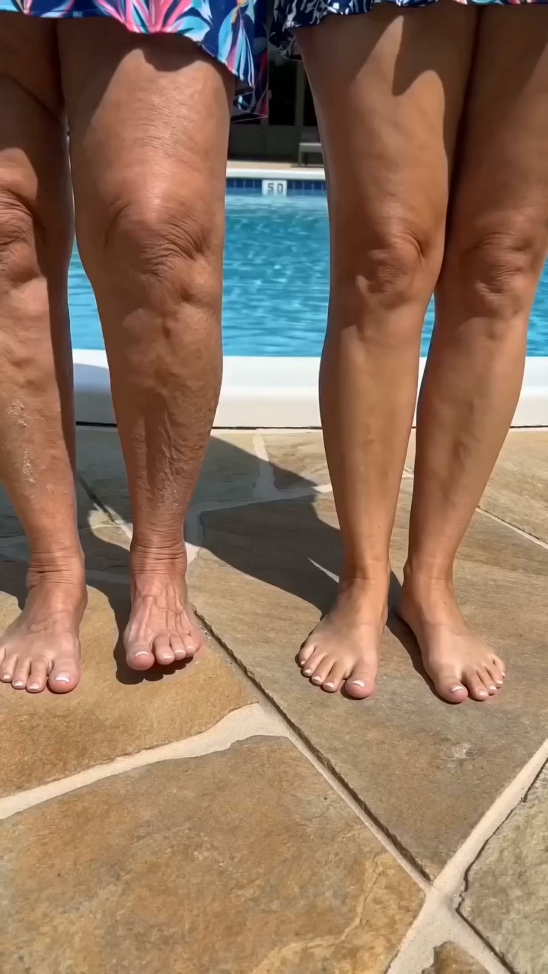 Miami MD ad: Why crepey skin keeps coming back — even after expensive creams.