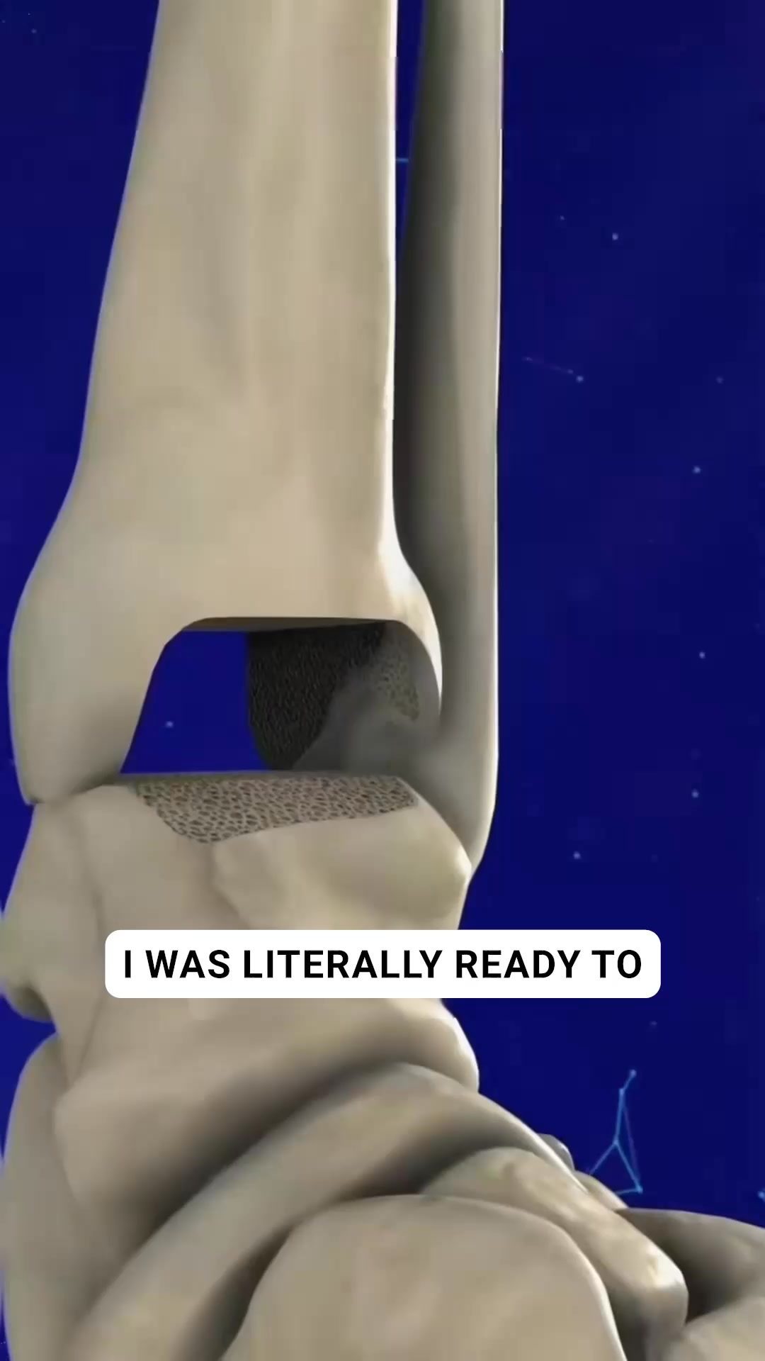 OrthoFlexx ad: Arch Support That Doesn't Collapse