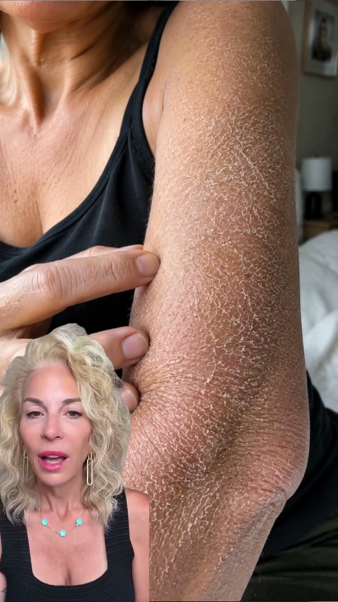 Miami MD ad: Why Lotions Don’t Work for Crepey Skin (and What Actually Does)