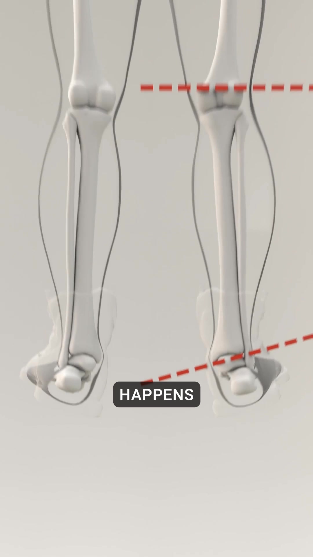 OrthoFlexx ad: Arch Support That Doesn't Collapse