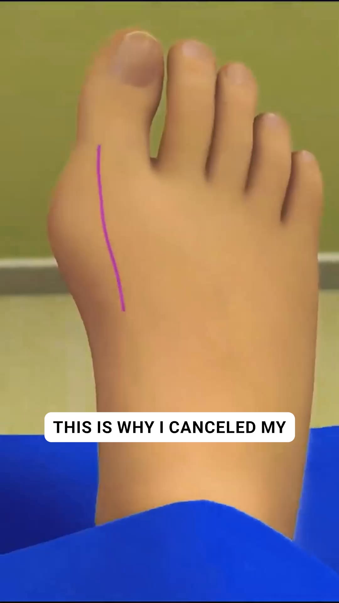 OrthoFlexx ad: Arch Support That Doesn't Collapse