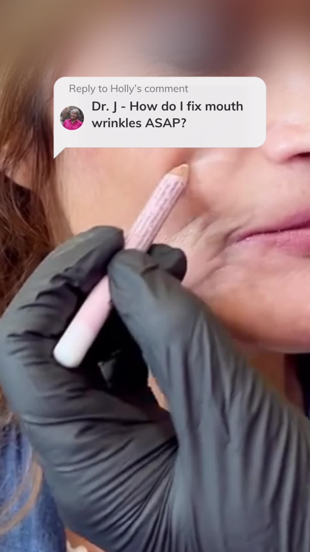 Miami MD ad: The best way to erase wrinkles?