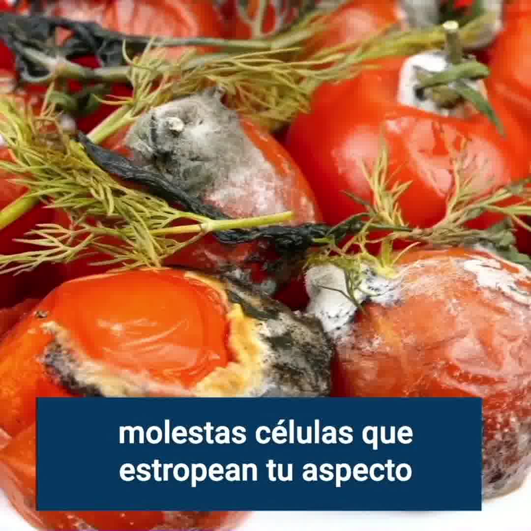 Miami MD ad: La forma natural de eliminar las manchas oscuras
