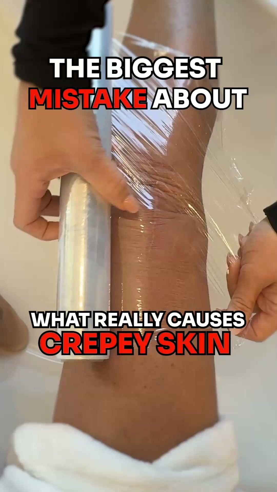 Miami MD ad: The real reason crepey skin won't go away.